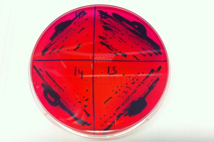 Bacteria cultures on agar plate