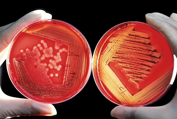 Bacterial cultures on agar